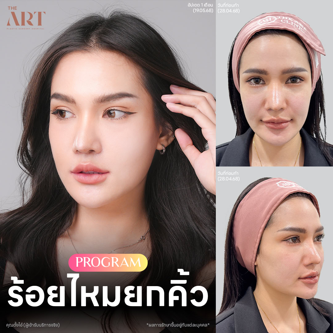 ร้อยไหม-แฟชั่นเช็ต-คุณ-ตั้งโอ๋-1.jpg