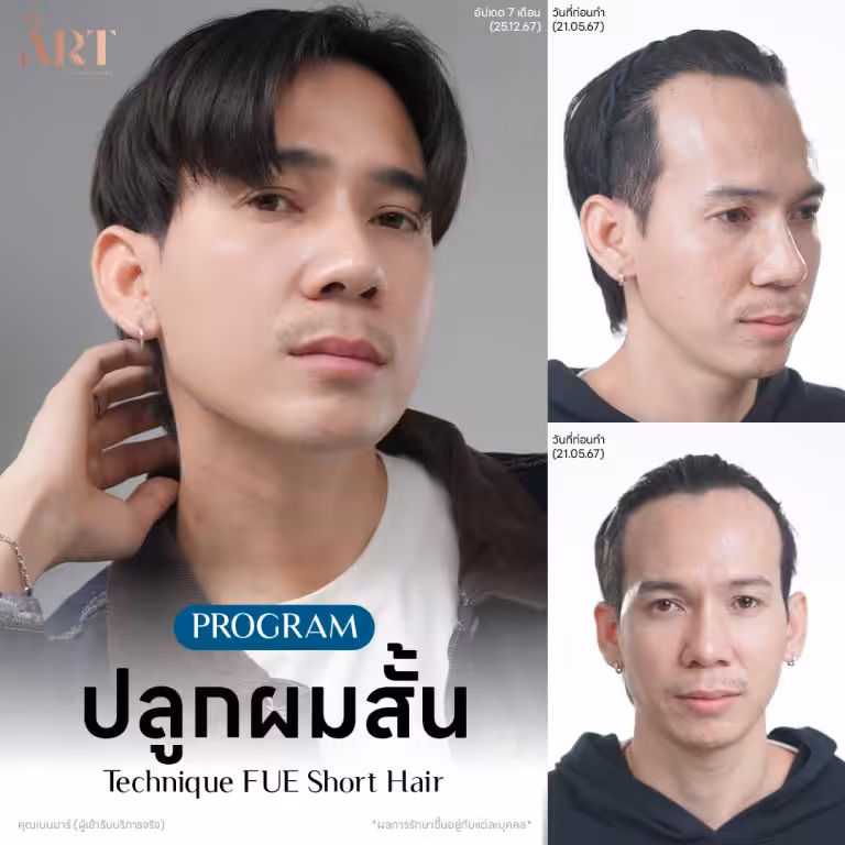 เต้-นันทศัย-1.jpg